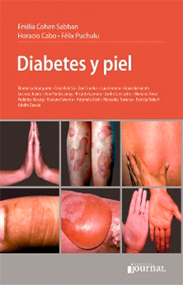 DIABETES Y PIEL