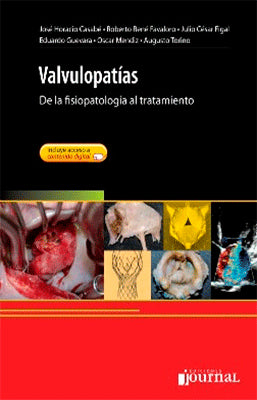 VALVULOPATIAS DE LA FISIOPATOLOGIA AL TRATAMIENTO