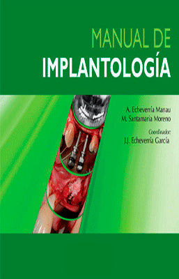 MANUAL DE IMPLANTOLOGIA