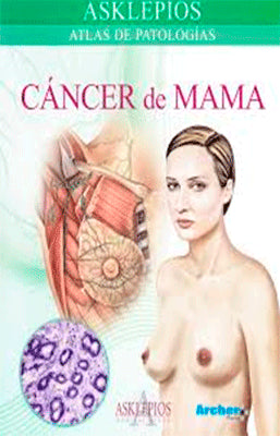 ASKLEPIOS CANCER DE MAMA