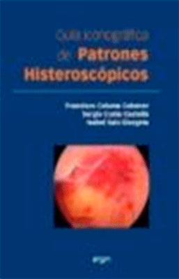 GUIA ICONOGRAFICA DE PATRONES HISTEROSCOPICOS
