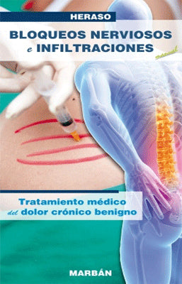 BLOQUEOS NERVIOSOS E INFILTRACIONES. CHICO