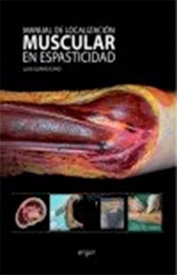 MANUAL DE LOCALIZACION MUSCULAR EN ESPASTICIDAD