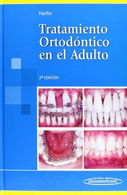 TRATAMIENTO ORTODONTICO EN EL ADULTO