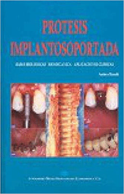 PROTESIS IMPLANTOSOPORTADA