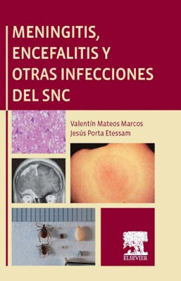 MENINGITIS ENCEFALITIS Y OTRAS INFECCIONES DEL SNC