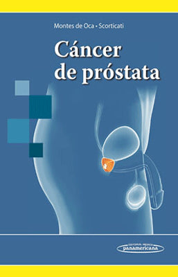 CANCER DE PROSTATA