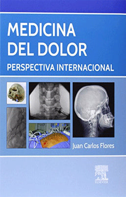 MEDICINA DEL DOLOR PERSPECTIVA INTERNACIONAL