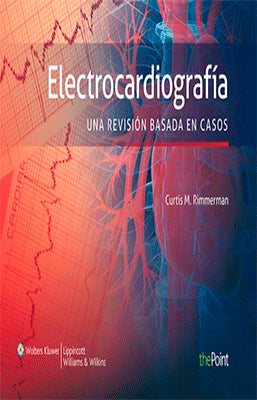 ELECTROCARDIOGRAFIA UNA REVISION BASADA EN CASOS