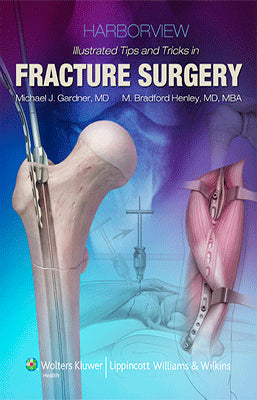 HARBORVIEW ILLUSTRATED TIPS AND TRICKS IN FRACTURE SURGERY