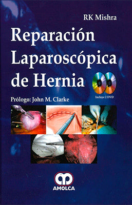 REPARACION LAPAROSCOPICA DE HERNIA + 2 DVD