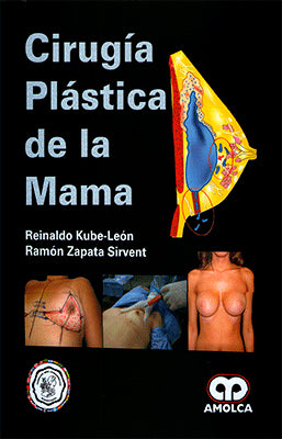CIRUGIA PLASTICA DE LA MAMA