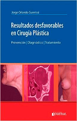 RESULTADOS DESFAVORABLES EN CIRUGIA PLASTICA