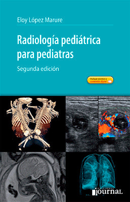 RADIOLOGIA PEDIATRICA PARA PEDIATRAS 2DA EDICION