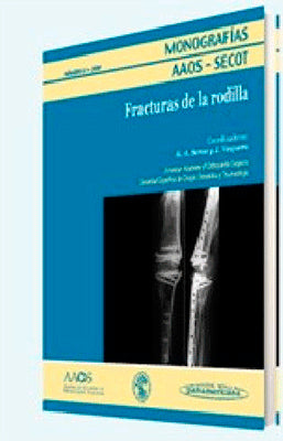 MONOGRAFIAS AAOS-SECOT FRACTURAS DE LA RODILLA
