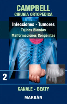 CAMPBELL CIRUGIA ORTOPEDICA  INFECCIONES TUMORES 2
