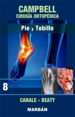CAMPBELL CIRUGIA ORTOPEDICA PIE Y TOBILLO 8