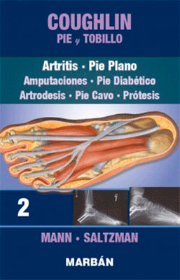 COUGHLIN PIE Y TOBILLO ARTRITIS PIE PLANO 2