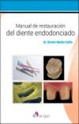 MANUAL DE RESTAURACION  DEL DIENTE ENDODONCIADO