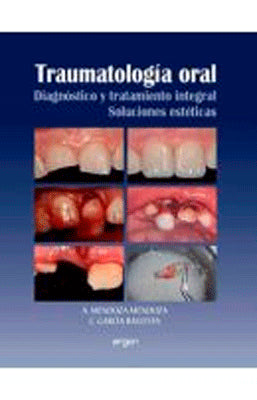 TRAUMATOLOGIA ORAL DIAGNOSTICO Y TRATAMIENTO INTEGRAL SOLUCIONES ESTETICAS