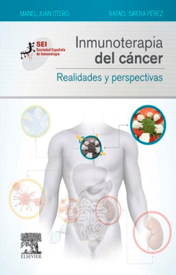 INMUNOTERAPIA DEL CANCER. REALIDADES Y PERSPECTIVAS