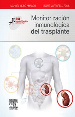 MONITORIZACION INMULOGICA DEL TRASPLANTE