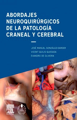 ABORDAJES NEUROQUIRURGICOS DE LA PATOLOGIA CRANEAL Y CEREBRAL