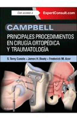 CAMPBELL: PRINCIPALES PROCEDIMIENTOS EN CIRUGIA ORTOPEDICA Y TRAUMATOLOGIA