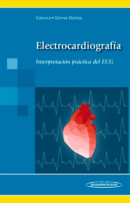 ELECTROCARDIOGRAFIA: INTERPRETACION PRACTICA DEL ECG