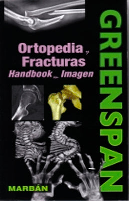 GREENSPAN ORTOPEDIA Y FRACTURAS HANBOOK EN IMAGEN