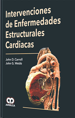 INTERVENCIONES DE ENFERMEDADES ESTRUCTURALES CARDIACAS