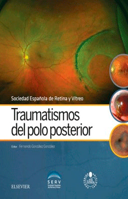 TRAUMATISMOS DEL POLO POSTERIOR