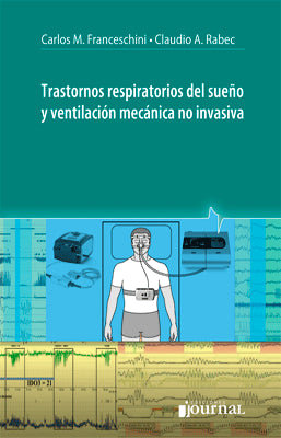 TRASTORNOS RESPIRATORIOS DEL SUEÑO Y VENTILACION MECANIDA NO INVASIVA