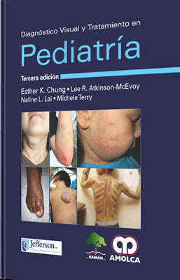 DIAGNOSTICO VISUAL Y TRATAMIENTO EN PEDIATRIA