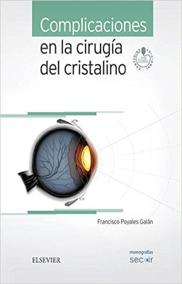 COMPLICACIONES EN LA CIRUGIA DEL CRISTALINO