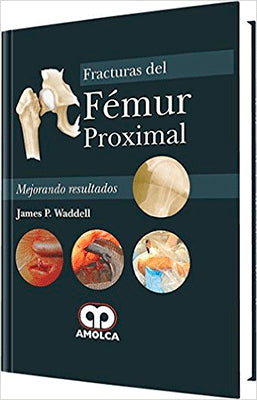 FRACTURAS DEL FEMUR PROXIMAL