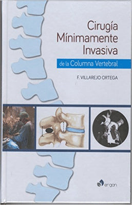 CIRUGIA MINIMAMENTE INVASIVA DE LA COLUMNA VERTEBRAL