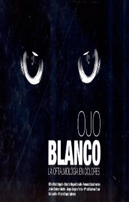 OJO BLANCO LA OFTALMOLOGIA EN COLORES