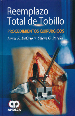 REEMPLAZO TOTAL DE TOBILLO PROCEDIMIENTOS QUIRURGICOS