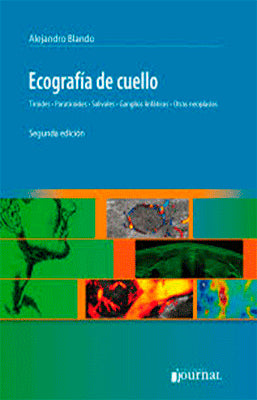 ECOGRAFIA DE CUELLO TIROIDES PARATIROIDES SALIVALES GANGLIOS LINFATICOS OTRAS NEOPLASIAS