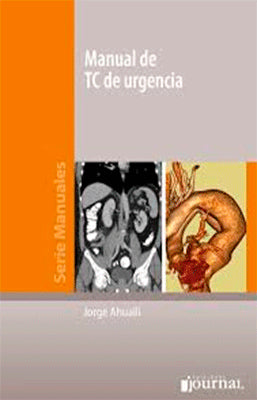 MANUAL DE TC DE URGENCIA