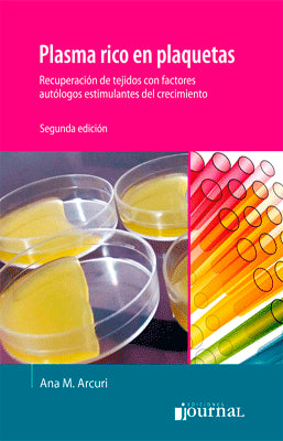 PLASMA RICO EN PLAQUETAS