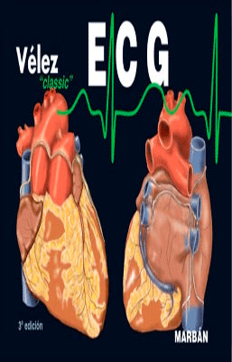 VELEZ CLASSI ECG