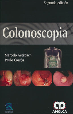 COLONOSCOPIA