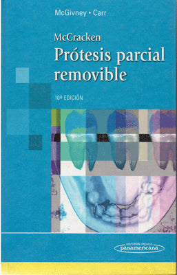 PROTESIS PARCIAL REMOVIBLE
