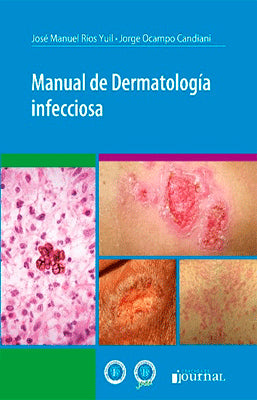MANUAL DE DERMATOLOGIA INFECCIOSA