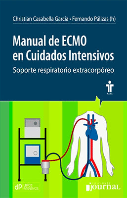 MANUAL DE ECMO EN CUIDADOS INTENSIVOS