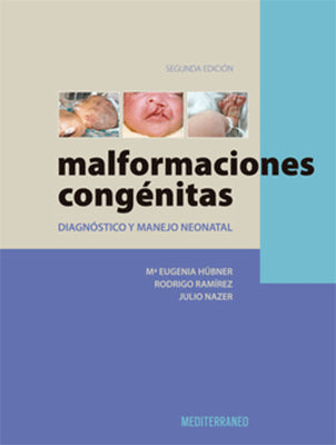 MALFORMACIONES CONGENITAS