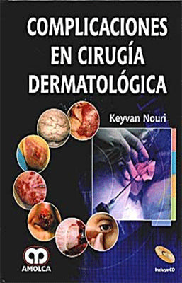 COMPLICACIONES EN CIRUGIA DERMATOLOGIA + CD