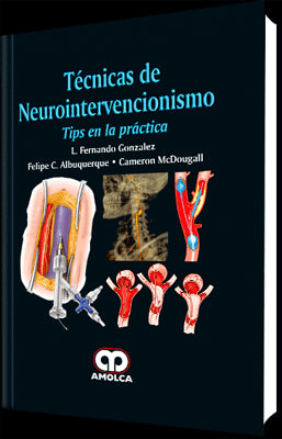 TECNICAS DE NEUROINTERVENCIONISMO TIPS EN LA PRACTICA